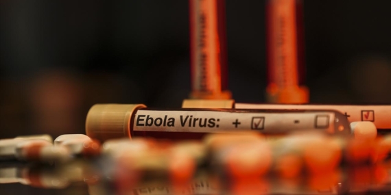 ebola-virus-aa-2463950.jpg
