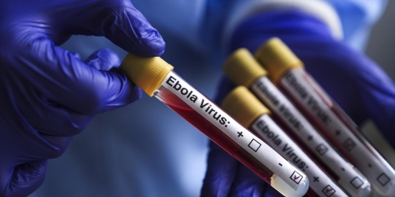 ebola-virus-aa-2463951.jpg