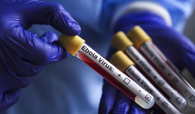ebola-virus-aa-2463951.jpg