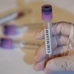 hantavirus-2459284.jpg