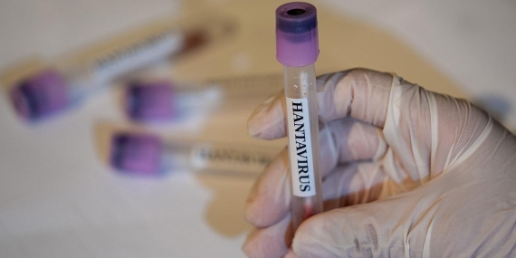 hantavirus-2459284.jpg