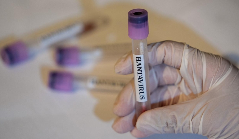 hantavirus-2459284.jpg