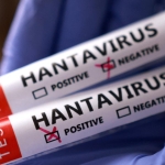 hantavirus-reu-2459423.jpg