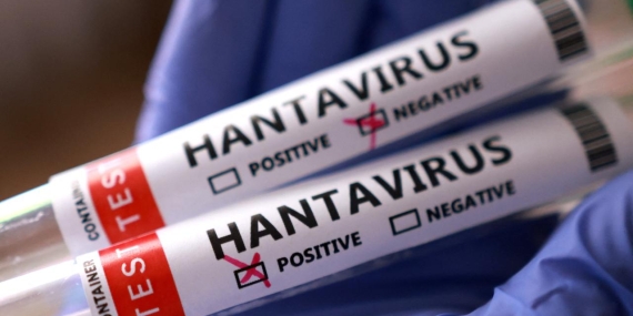 hantavirus-reu-2459423.jpg