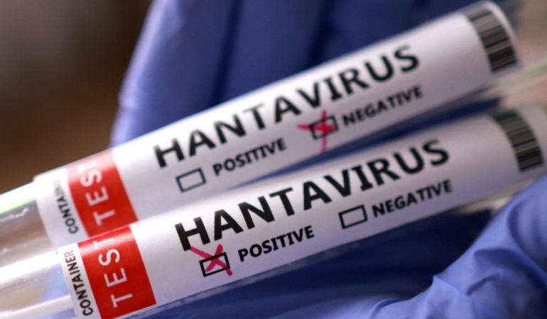 hantavirus-reu-2459423.jpg