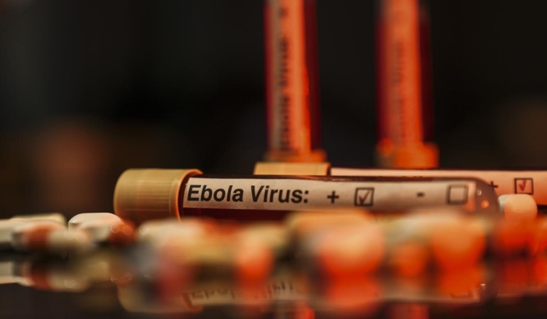 ebola-virus-aa-2463950.jpg