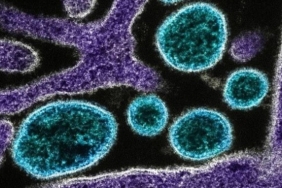 nipah-virusu-getty-2107428.jpg