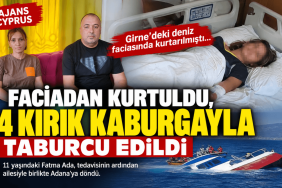faciadan-kurtuldu-dort-kirik-kaburgayla-taburcu-edildi-ajanscyprus (1)